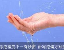 �����̶Ȳ�һ������ �ζ���ƫ����֢��ҩ